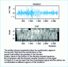 Figure 7 - Oscillometric data generated by a simulator (BP Pump), in order to produce a high level of motion artifact due to transport on a gravel road.