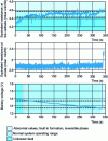 Figure 18 - Estimating numerical values for equivalent resistances