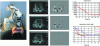 Figure 15 - Direct visual servoing presented in [133] to bring a 2D ultrasound probe back to a reference configuration relative to an organ. On the left, the robot carrying the probe in contact with an abdominal phantom. In the middle, the evolution of the ultrasound image (column 2) and image error (column 3) between the initial configuration (top), at t = 4 s (middle) and t = 15 s (bottom). The area of interest (in blue) remains fixed in the image, and the error is the pixel-by-pixel difference between desired and current content. The image is modified over time by the displacement of the probe, and the error converges to a low error represented by a gray uniform difference image. On the right, convergence curves in the image and in 3D (reproduced by kind permission of A. Krupa).