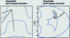 Figure 9 - Singular and non-singular posture changes of a 3R cuspidal robot (in the joint space on the left, in the working space on the right)