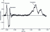 Figure 9 - BLEVE overpressure signal