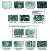 Figure 3 - Main micrographic microstructures of steel