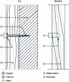 Figure 25 - Through-rafter mounting