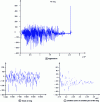 Figure 2 - Recording eeg and viewing two zooms