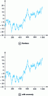 Figure 38 - Problems detecting small anomalies