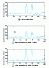 Figure 14 - Channel analysis