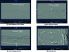 Figure 34 - Visualization in Difference left – right mode (Credit Tektronix/Ina)