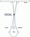 Figure 13 - Horizontal angular parallax is defined by the angle DPG; D and G are the points of the right and left images displayed on the screen, representing the same point perceived in front of the screen.