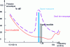 Figure 3 - Perceptual model of the human ear and frequency masking