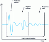 Figure 4 - Transient response of a target