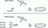 Figure 4 - Illustrating the differences between direct and indirect access