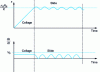 Figure 9 - Theoretical evolution of skid displacement and speed with identical static and dynamic friction