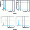 Figure 56 - Signal spectra in normal and tangential directions for steel/copper tests