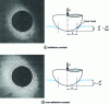 Figure 11 - Newton's ring networks of the surface of a flexible rubber mass near the contact edge of a glass sphere