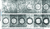 Figure 19 - Evolution of the annular micro-slip zone in the contact area between a rigid sphere and a rubber mass with increasing amplitudes