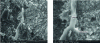 Figure 19 - SEM images of the implantation and development of filamentous algae on a carbonated UHP surface.