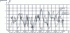 Figure 20 - Variation in adhesion over several years (from [27])