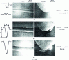 Figure 15 - Scanning electron microscope observation of the morphology of plastic flows induced by a ball of radius R = 25 µm in 100Cr6 steel hardened to HV = 5.6 GPa for three penetrations (after [11]).