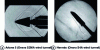 Figure 20 - Visualization of shock waves using strioscopy (source: Onera)