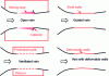 Figure 5 - Different types of test section