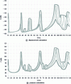 Figure 37 - Typical frequency response including parametric dependence in a vibroacoustic solution represented as a separate variable (after [50] [51]).